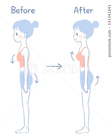 Hip lift and bust lift before and after: Illustration of a woman Hip lift and bust lift before and after: Illustration of a woman 141341841