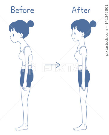 一位女士改善體態（駝背/挺頸）前後對比照片 141345001