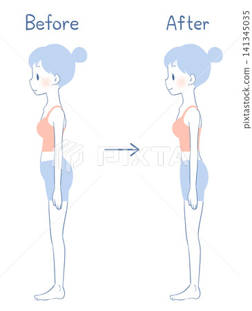 Before and after photos of a woman correcting lordosis (swayback). Before and after photos of a woman correcting lordosis (swayback). 141345035
