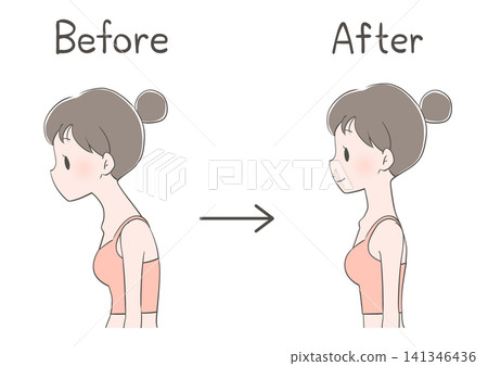 Before and After Photos of a Woman Improving Her Posture (Hunchback/Straight Neck) Before and After Photos of a Woman Improving Her Posture (Hunchback/Straight Neck) 141346436