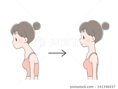 Before and After Photos of a Woman Improving Her Posture (Hunchback/Straight Neck) Before and After Photos of a Woman Improving Her Posture (Hunchback/Straight Neck) 141346437