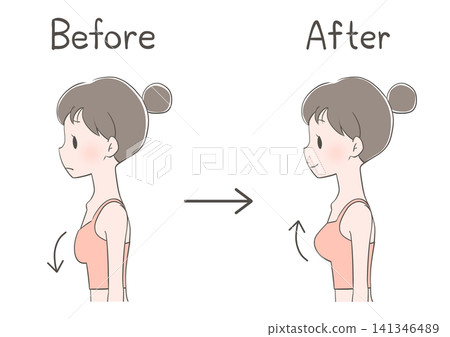 Breast augmentation before and after: Illustration of a woman Breast augmentation before and after: Illustration of a woman 141346489