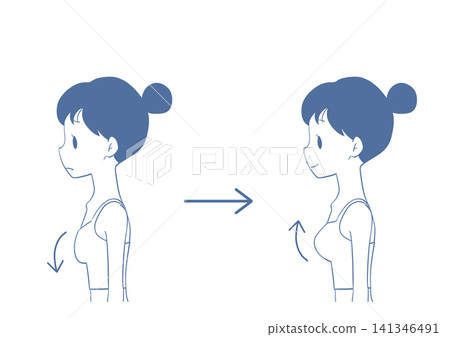 Breast augmentation before and after: Illustration of a woman Breast augmentation before and after: Illustration of a woman 141346491