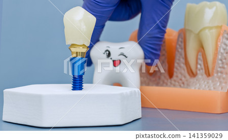 Dentist hand in a blue glove holding a cute winking tooth character behind a dental implant on a light blue background. Dentist hand in a blue glove holding a cute winking tooth character behind a dental implant on a light blue background. 141359029