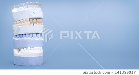 Stack of dental plaster molds with clear orthodontic aligner on top. Wide blue background with copy space. Stack of dental plaster molds with clear orthodontic aligner on top. Wide blue background with copy space. 141359037