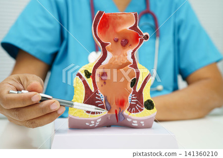 Uterus, doctor holding human anatomy model for study diagnosis and treatment in hospital. Uterus, doctor holding human anatomy model for study diagnosis and treatment in hospital. 141360210