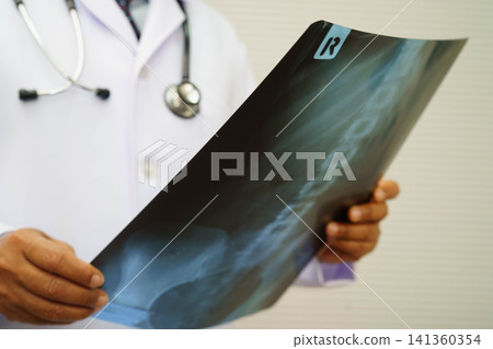 Doctor examining spine bone radiography xray film. Doctor examining spine bone radiography xray film. 141360354
