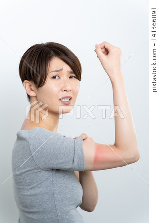 A woman with a red sunburn A woman with a red sunburn 141366091