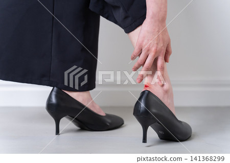 Woman with blisters from wearing pumps - special effects makeup Woman with blisters from wearing pumps - special effects makeup 141368299