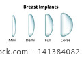 Breast implants medical illustration showing varying projection profiles 141384082