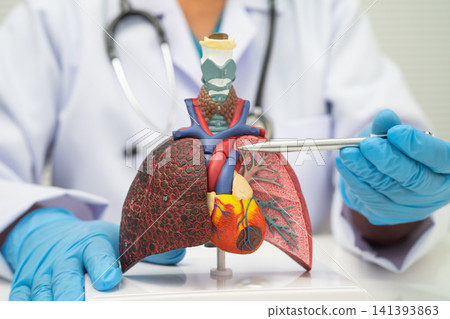 Pneumonia, lung cancer, Asian doctor holding human model. Pneumonia, lung cancer, Asian doctor holding human model. 141393863