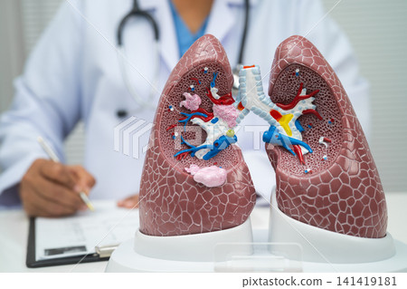 Pneumonia, lung cancer, Asian doctor with human lung model. Pneumonia, lung cancer, Asian doctor with human lung model. 141419181