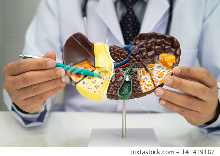 Liver with gallbladder, pancreas spleen and duodenum, Asian doctor holding human anatomy model for study diagnosis and treatment in hospital. Liver with gallbladder, pancreas spleen and duodenum, Asian doctor holding human anatomy model for study diagnosis and treatment in hospital. 141419182