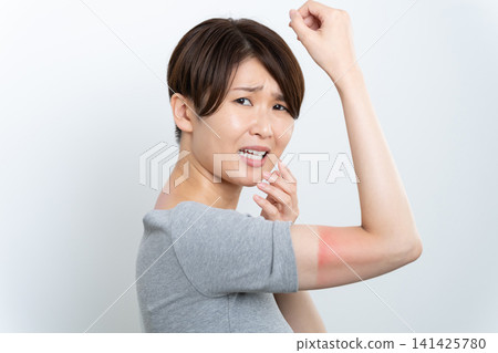 一位曬傷嚴重的女性 一位曬傷嚴重的女性 141425780