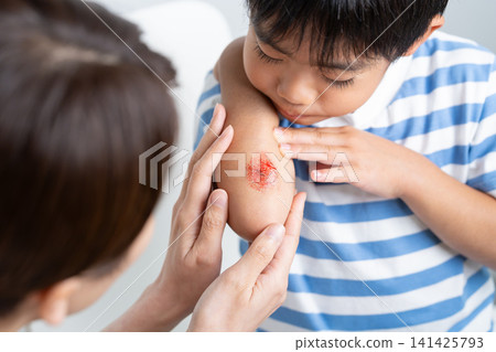 一個孩子手臂擦傷,他的母親正在照顧他──這是特效化妝。 一個孩子手臂擦傷,他的母親正在照顧他──這是特效化妝。 141425793