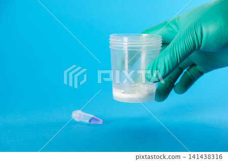 A doctor holds a medical container with ejaculate in his hand against a blue background. Conceptual illustration of a spermogram test for sperm motility and the male reproductive system. Copy space A doctor holds a medical container with ejaculate in his hand against a blue background. Conceptual illustration of a spermogram test for sperm motility and the male reproductive system. Copy space 141438316