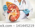Chronic kidney disease, doctor with model for treatment urinary system, urology, Estimated glomerular filtration rate eGFR. 141445219
