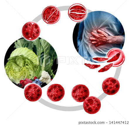 Cyclosporiasis Food Poisoning Cyclosporiasis Food Poisoning 141447412