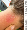 child, insect, kid 141471194