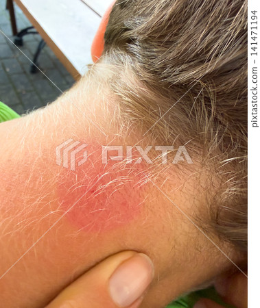child, insect, kid 141471194