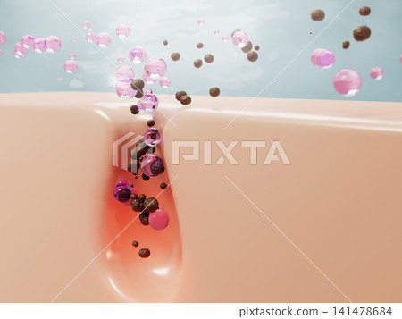 3d cleansing clogged pores with pink gel bubbles. Face cleanser, rose water toner or lotion drops, liquid cosmetic spheres for skin care. Acne treatment, remove blackheads, ad banner. 3D illustration 3d cleansing clogged pores with pink gel bubbles. Face cleanser, rose water toner or lotion drops, liquid cosmetic spheres for skin care. Acne treatment, remove blackheads, ad banner. 3D illustration 141478684