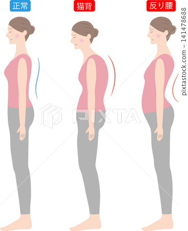 姿勢正確的女性,駝背和腰椎前凸都比較少見。 姿勢正確的女性,駝背和腰椎前凸都比較少見。 141478688
