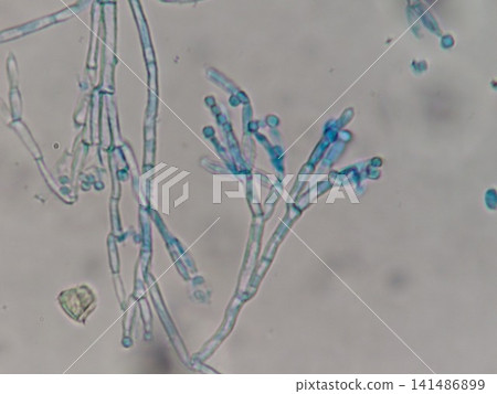 青黴菌屬的分生孢子 141486899