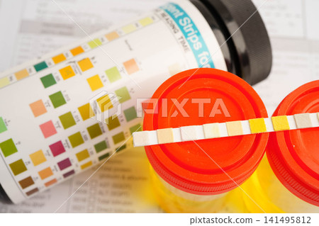 Urinalysis, urine cup with reagent strip pH paper test and comparison chart in laboratory. 141495812