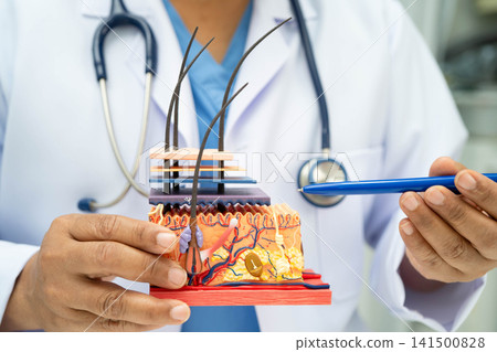Hair transplant, Asian dermatologist doctor holding skin structure anatomy model for treatment in hospital. Hair transplant, Asian dermatologist doctor holding skin structure anatomy model for treatment in hospital. 141500828