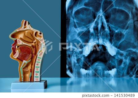 Human nasal cavity anatomy model stands beside sinus X-ray in medical clinic. ENT diagnosis and patient examination 141530489