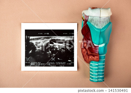 Thyroid gland anatomical model with ultrasound image in medical clinic. Thyroid diagnosis and patient examination 141530491