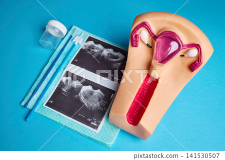 Female reproductive system model with cervical screening tools and ultrasound report. Gynecology diagnostic concept Female reproductive system model with cervical screening tools and ultrasound report. Gynecology diagnostic concept 141530507
