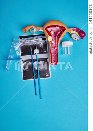 Women's reproductive healthcare concept with uterus model and gynecology examination tools Women's reproductive healthcare concept with uterus model and gynecology examination tools 141530508