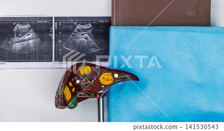 Anatomical liver model with ultrasound printouts on medical desk. Liver screening and diagnosis. Anatomical liver model with ultrasound printouts on medical desk. Liver screening and diagnosis. 141530543