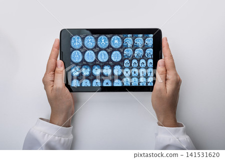 Professional scientist reviewing digital magnetic resonance imaging of patient head on tablet screen. Neurology exam. Professional scientist reviewing digital magnetic resonance imaging of patient head on tablet screen. Neurology exam. 141531620