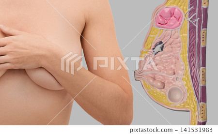 Woman performing breast self-examination next to anatomical mammary gland model. Prevention and early diagnostics of breast cancer. Woman performing breast self-examination next to anatomical mammary gland model. Prevention and early diagnostics of breast cancer. 141531983