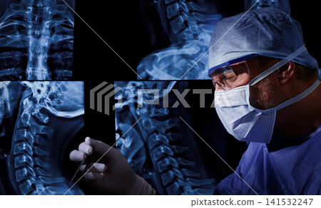 Experienced surgeon during surgical procedure on cervical spine neck area. Neurosurgeon operating on patient vertebral column. Experienced surgeon during surgical procedure on cervical spine neck area. Neurosurgeon operating on patient vertebral column. 141532247