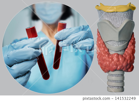 Nurse in protective gloves holding blood tubes next to anatomical thyroid gland model. Hormonal blood test diagnostics in endocrinology clinic. Nurse in protective gloves holding blood tubes next to anatomical thyroid gland model. Hormonal blood test diagnostics in endocrinology clinic. 141532249