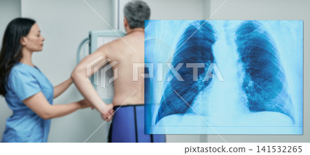 Patient undergoing lung radiography next to prominent chest X-ray image in foreground. Pulmonology examination. 141532265