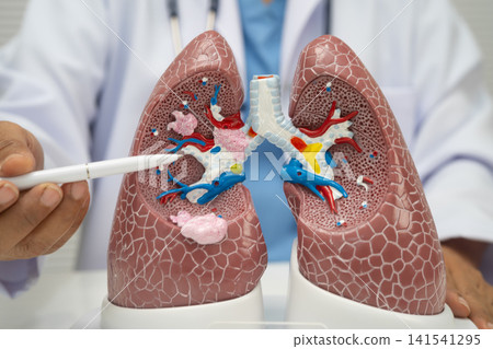 Pneumonia, lung cancer, Asian doctor with human lung model. Pneumonia, lung cancer, Asian doctor with human lung model. 141541295