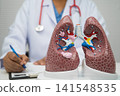 Pneumonia, lung cancer, Asian doctor with human lung model. 141548535