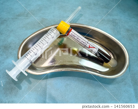 Blood sample in syringe and test tube on stainless steel tray Blood sample in syringe and test tube on stainless steel tray 141560653