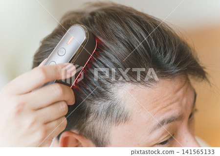 Close-up of a man's head using an LED brush to care for his hairline. Close-up of a man's head using an LED brush to care for his hairline. 141565133