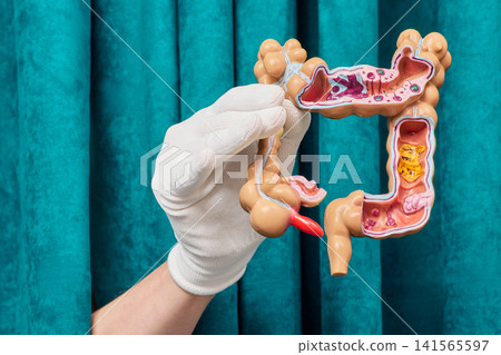 Visualizing digestive system pathology and bowel mucosa against curtain. Digestive tract health assessment and constipation relief. 141565597
