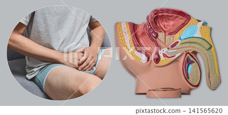 Medical collage of man sitting on sofa holding his groin and male pelvic organs anatomical model. Urology diagnostic consultation and prostatitis treatment. Medical collage of man sitting on sofa holding his groin and male pelvic organs anatomical model. Urology diagnostic consultation and prostatitis treatment. 141565620