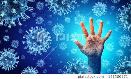 Measles Disease Outbreak 141580571
