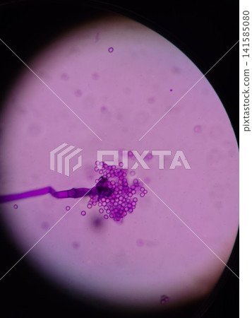 Rhizopus fungus observed with an optical microscope Rhizopus fungus observed with an optical microscope 141585080