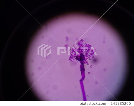 Microscopic photograph of mold stained purple for better visibility. Microscopic photograph of mold stained purple for better visibility. 141585260