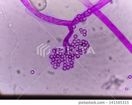 Flower-shaped fungal conidia Flower-shaped fungal conidia 141585315