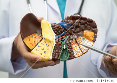Cirrhosis, Liver cancer, fatty liver, Asian doctor with liver human model. Cirrhosis, Liver cancer, fatty liver, Asian doctor with liver human model. 141613030